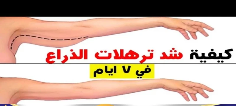 هتشد ترهلات الذراعين في 7 أيام فقط.. تركيبة تركية هتخلي جسمـك أحلى من نجوم هوليوود